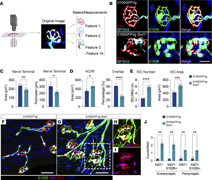 The remodeling of neuromuscular junctions (NMJs) is associated with grea...