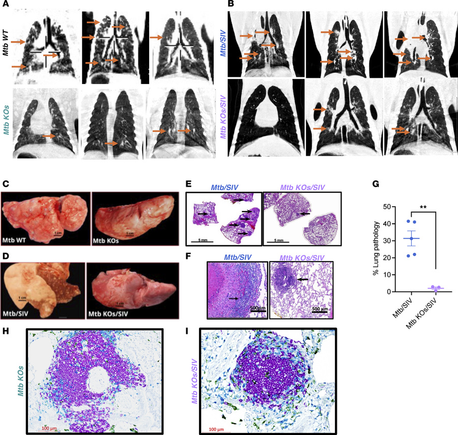 Lung pathology and TB lesions in Mtb KOs and Mtb KOs/SIV-cochallenged rh...