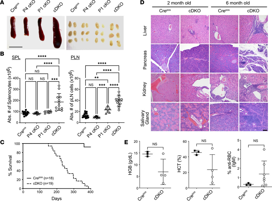 Combined absence of FOXP1 and FOXP4 induces lymphoproliferation and fata...