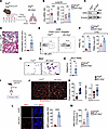 EC Erg loss induces PMN infiltration and activation.