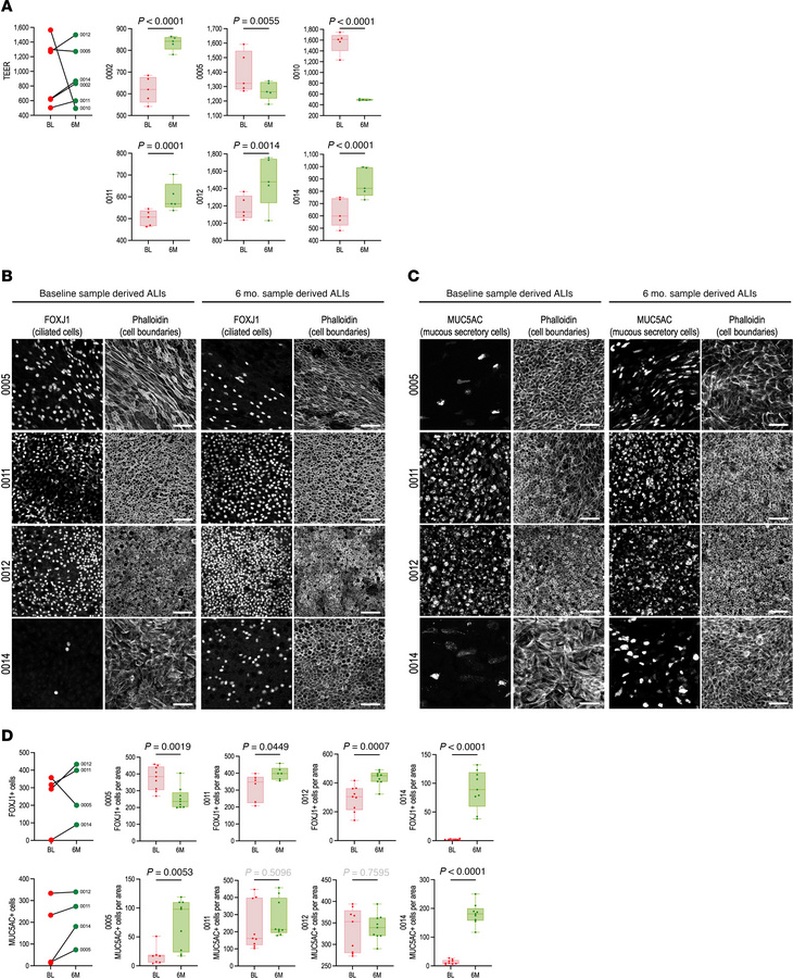 Improved epithelial structure and function in primary sinonasal airway e...