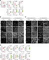 Improved epithelial structure and function in primary sinonasal airway epit