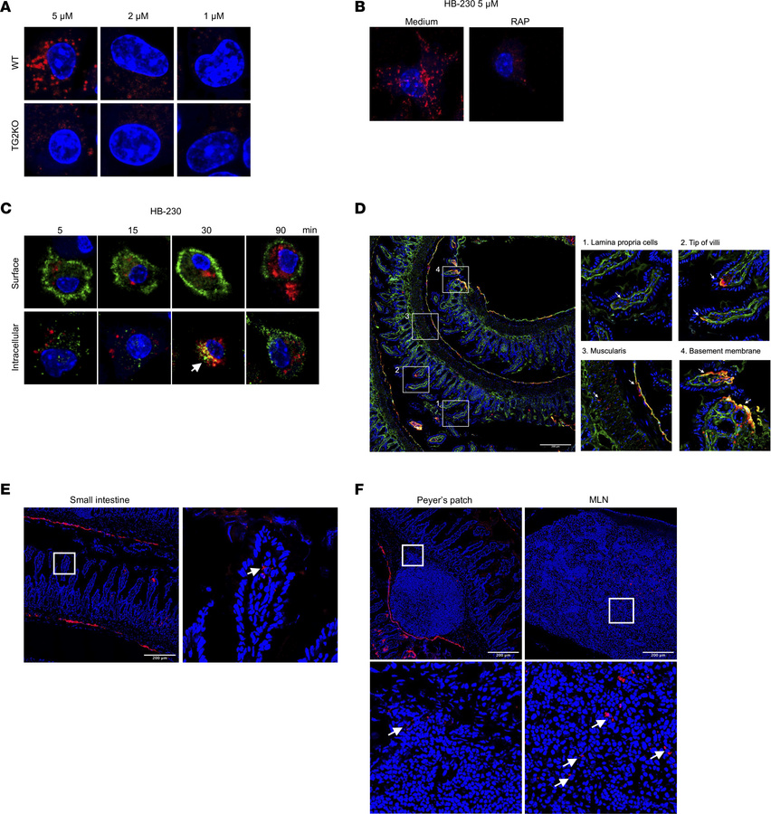 Detection of different active forms of TG2 by HB-230.
(A) Bone marrow–de...