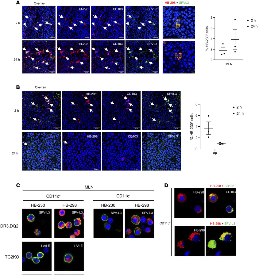 CD103+ DCs present gluten peptides in MLN in an HLA-DQ2–restricted manne...