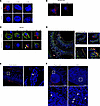 Detection of different active forms of TG2 by HB-230.