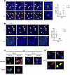 CD103+ DCs present gluten peptides in MLN in an HLA-DQ2–restricted manner.
