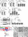 Impaired mitochondrial respiration in TAZ MKO soleus can be rescued by omeg
