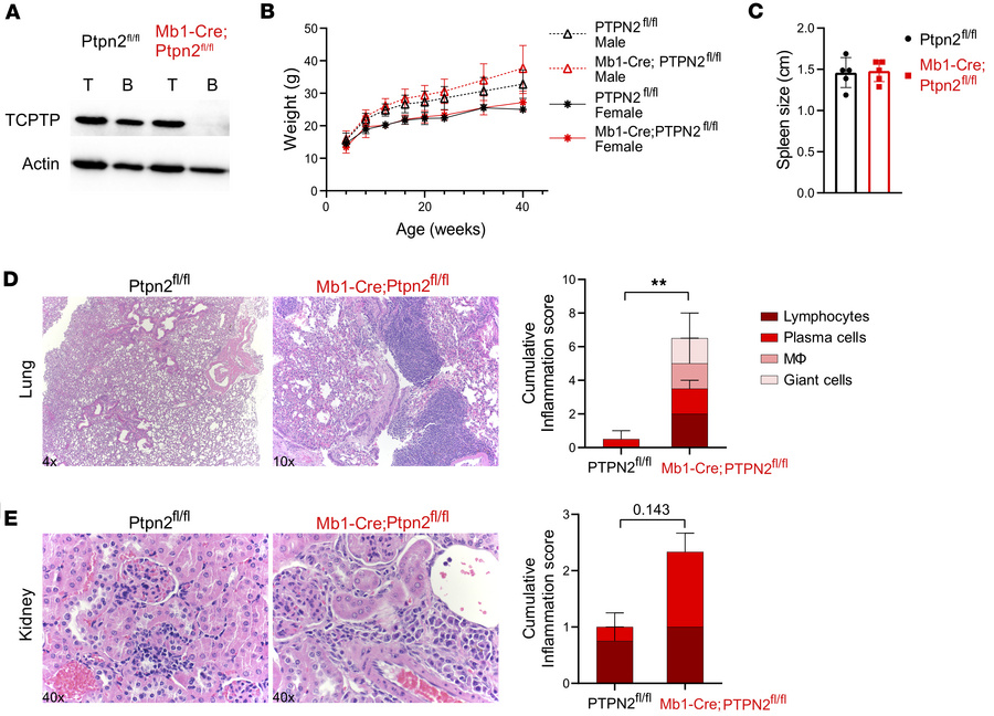 Elevated immune pathology in Mb1-Cre;Ptpn2fl/fl mice.
(A) Western blots ...