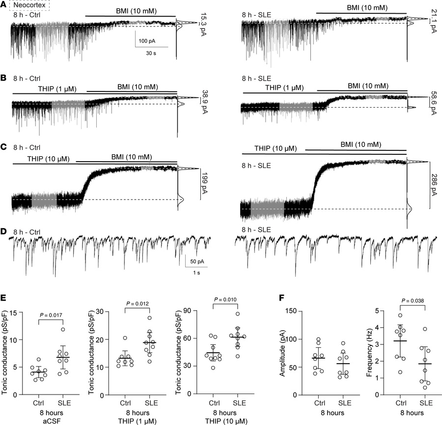 The total and δ-GABAAR–mediated tonic conductance increases in the neoco...