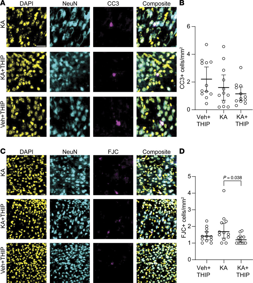 THIP does not cause neuronal apoptosis or degeneration in the neonatal b...