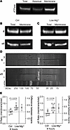 Recurrent neonatal seizure-like events for 8 hours increase the membrane ex