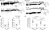 The α5-GABAAR–mediated currents increase after recurrent neonatal seizure-l