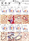 Day 28 CD8+ CAR19 T cells do not treat murine cGVHD/BOS, while CAR19 Tregs