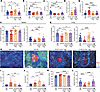 CAR19 Tregs inhibit GC reactions in murine cGVHD/BOS.