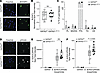 Homeostatic functions remain largely intact in GATA2-deficient alveolar mac