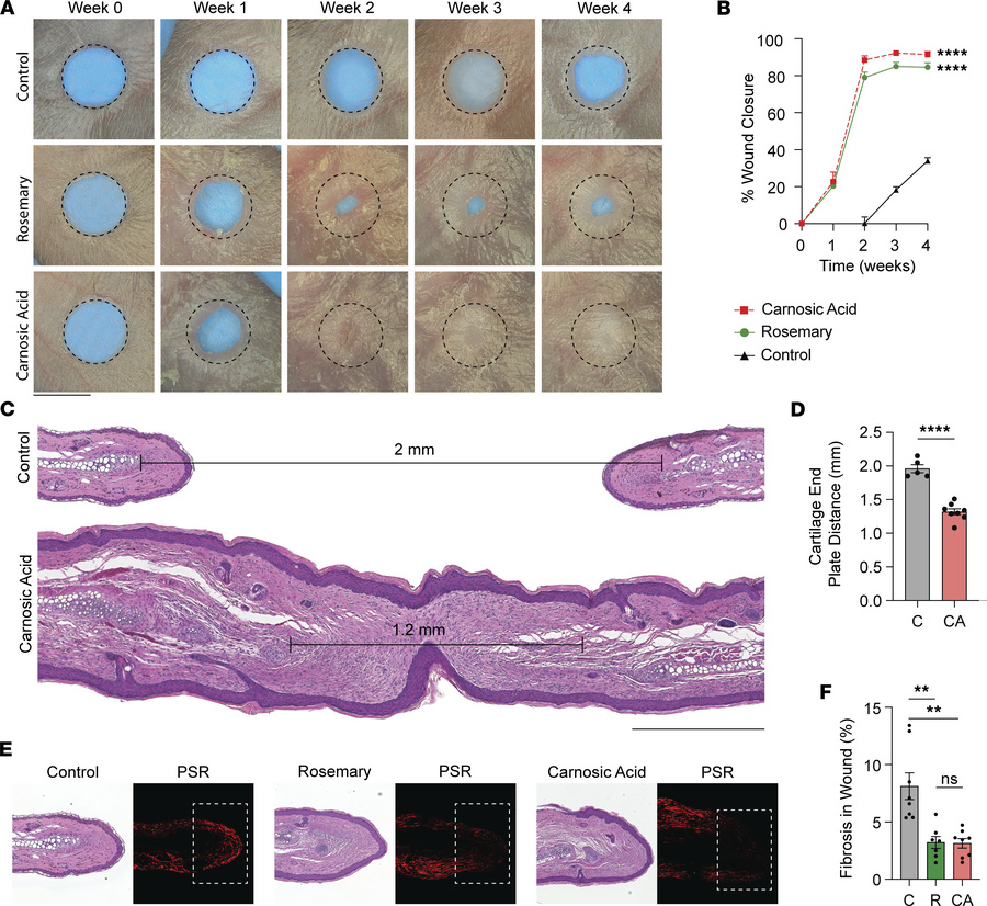 Topical carnosic acid cream promotes cutaneous mouse ear wound regenerat...