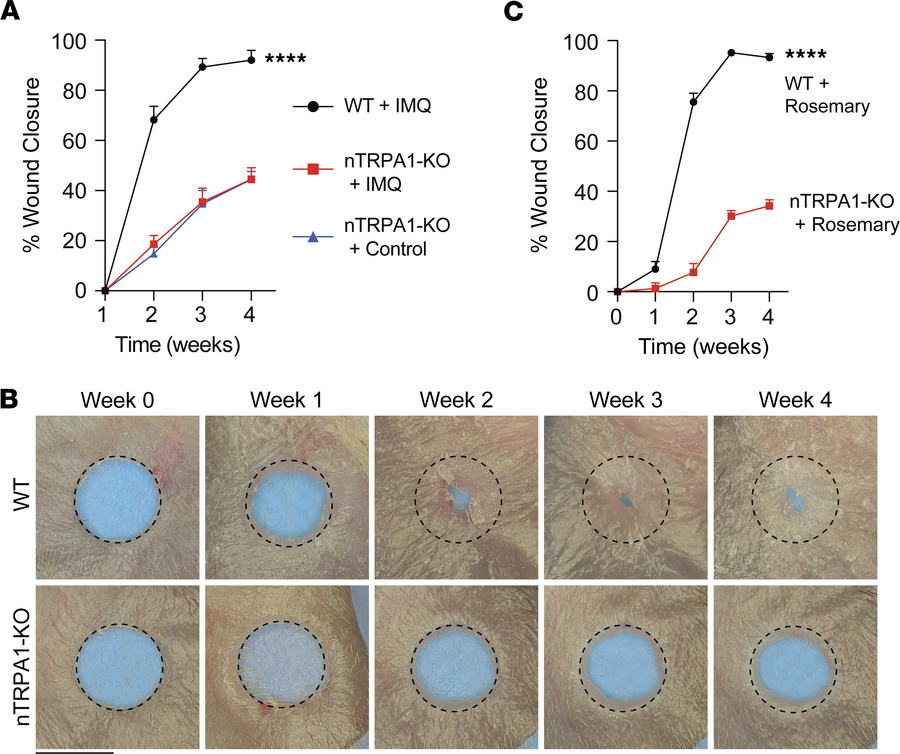 TRPA1 on cutaneous sensory neurons is necessary for rosemary cream-media...