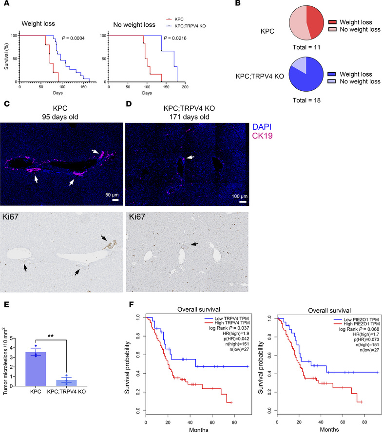 TRPV4 loss reduces metastases and increases survival in a GEMM model of ...