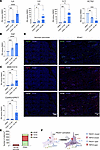 Piezo1 activation converts human PSCs to a FAPup-iCAF phenotype.