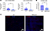 S100A8+ cells are reduced in livers of TRPV4-KO mice.