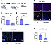 TRPV4 is necessary for hepatic metastasis of PDAC.