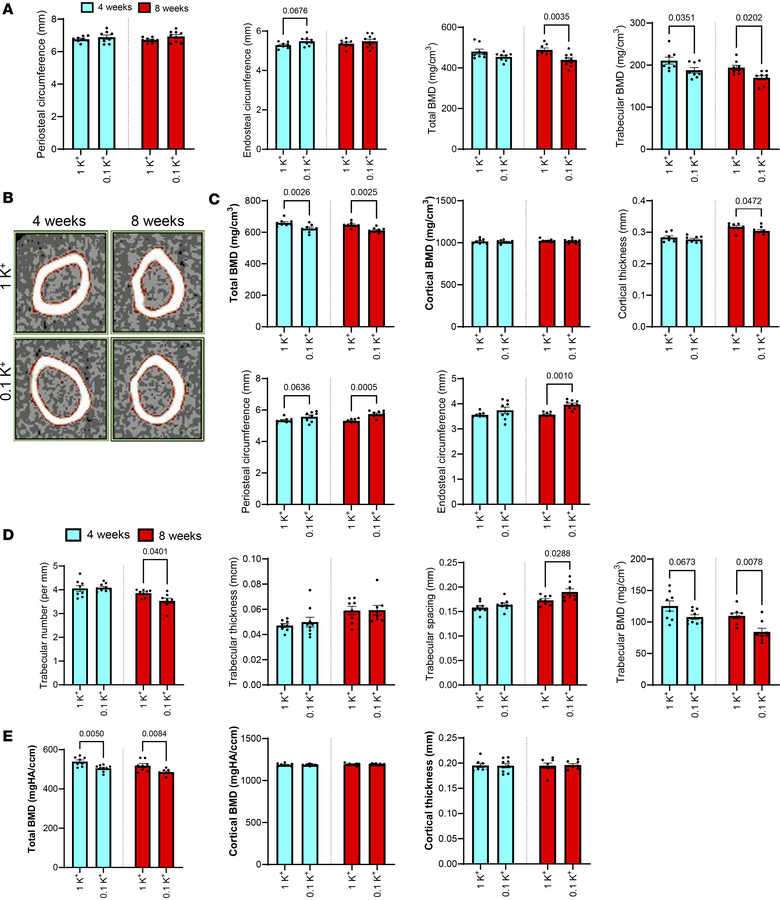 Dietary K+ restriction results in progressive loss of trabecular bone an...