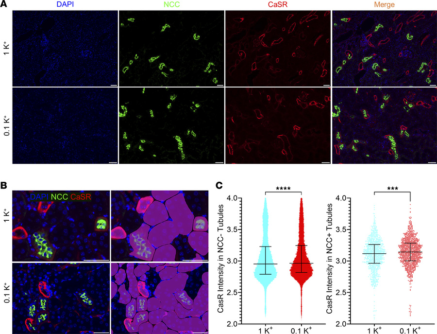 Low dietary K+ intake alters abundance of the calcium-sensing receptor (...