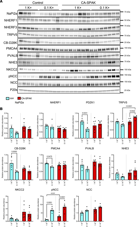 Low dietary K+ effects on various modulators of Ca2+, Pi and Na+ transpo...