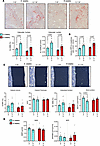Increased osteoclast number and surface during lower dietary K+ intake.