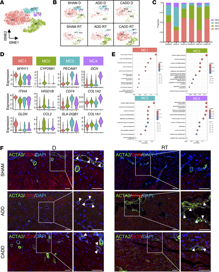 Identification of a specific ECM-related MC subcluster in the RT after A...