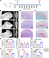 Zaprinast alleviates deformation of the disc and RT and damage of the condy