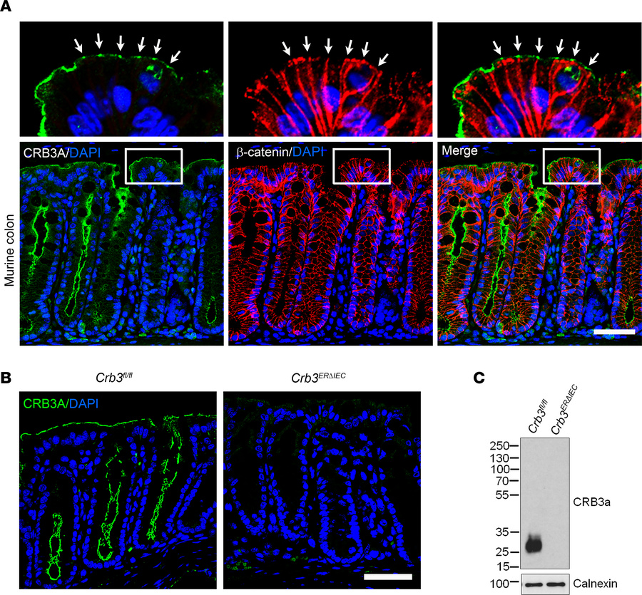 Inducible intestinal epithelial knockout of CRB3 (Crb3ERΔIEC).
(A) Confo...
