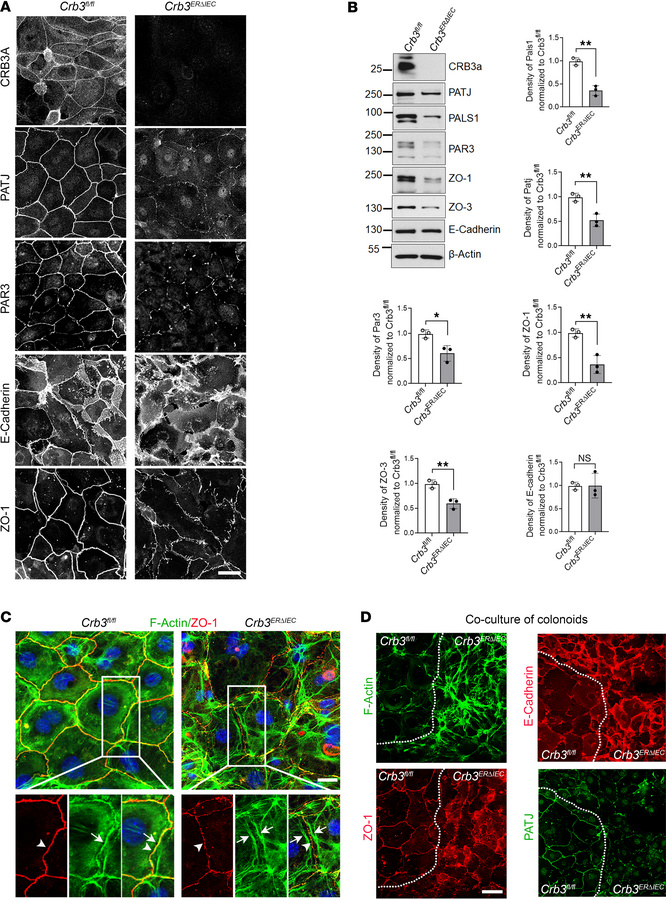 CRB3 regulates junctional localization of AJC proteins and organization ...