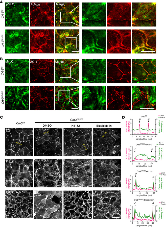 Inhibition of ROCK-II or p-MLC activity largely restores the defects in ...