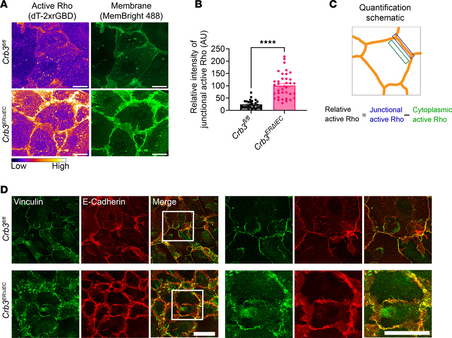 Loss of CRB3 results in increased junctional RhoA activity and increased...