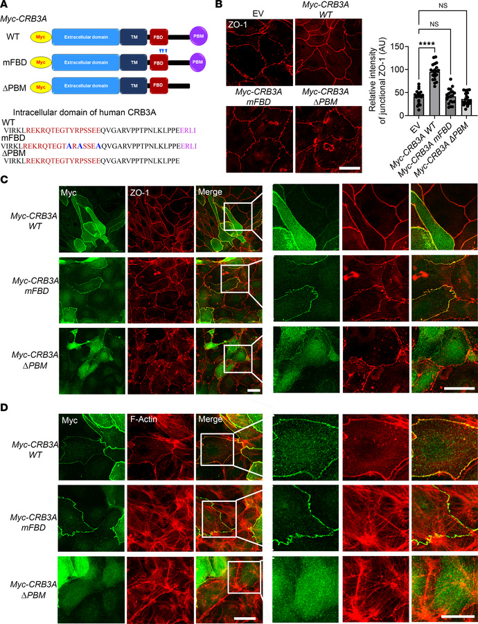 PDZ binding motif (PBM) and FERM binding domain (FBD) of CRB3A control a...