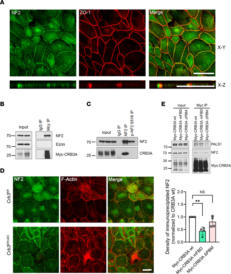 NF2 interacts with CRB3A in IECs and regulates epithelial junctional ass...