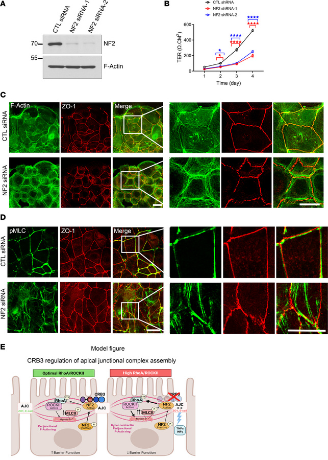 Loss of NF2 mimics the defects seen in CRB3-deficient IECs, including im...