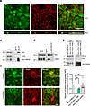 NF2 interacts with CRB3A in IECs and regulates epithelial junctional assemb