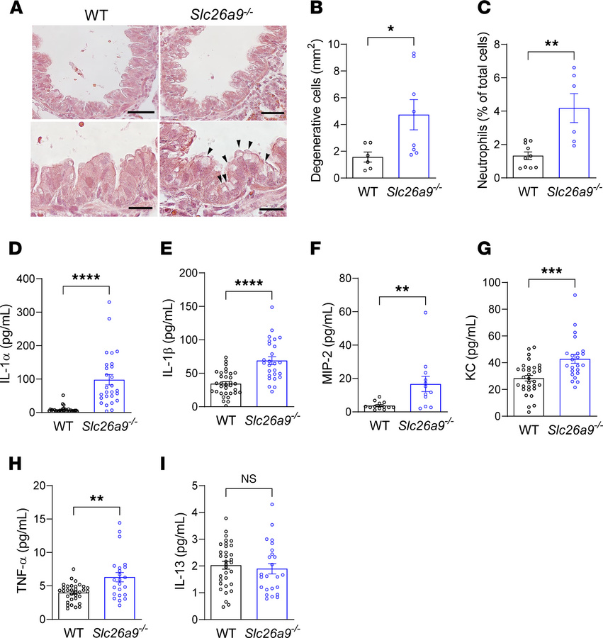 Genetic deletion of Slc26a9 is associated with airway epithelial cell de...