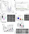 CRISPRi screen identifies druggable genes mediating GBM invasion in 3D hydr