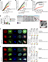 AURKB and LMW-PTP (ACP1) affect cortactin phosphorylation, altering actin p