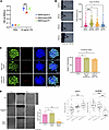 AURKB and ACP1 exert distinct effects on different aspects of GBM invasion.