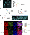 Targeting AURKB and ACP1 in orthotopic GBM xenografts in vivo slows invasio