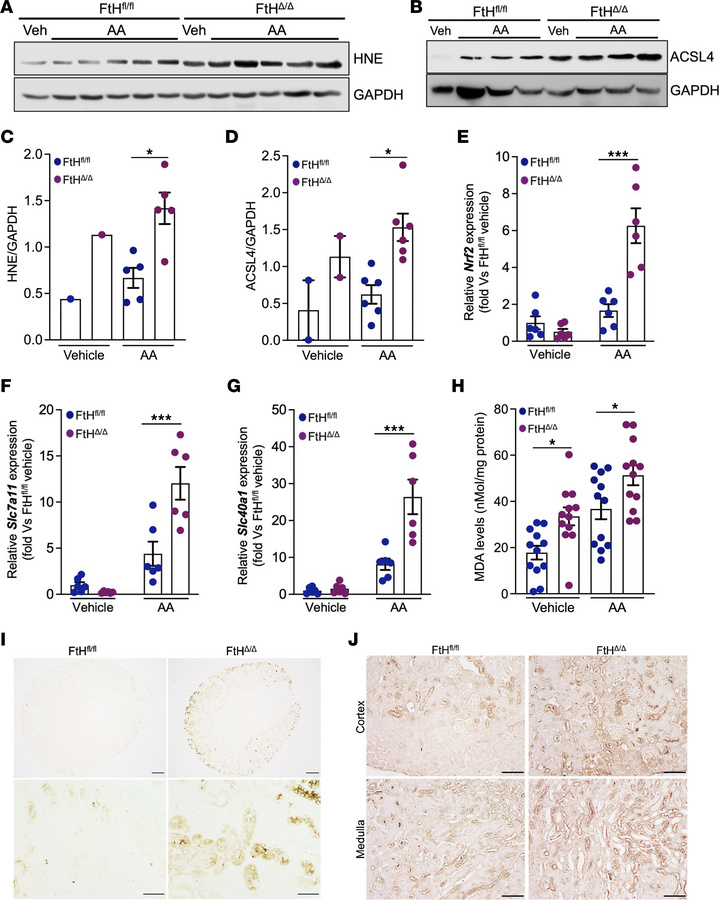 Myeloid FtH deficiency confers susceptibility to ferroptosis following i...