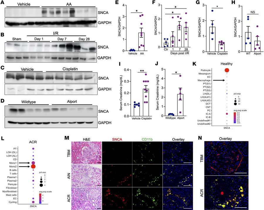 SNCA accumulation is a hallmark of kidney diseases marked by leukocyte e...