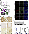 Myeloid FtH deletion triggers SNCA induction in macrophages.