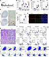 Myeloid FtH deficiency exacerbates AKI and accelerates AKI-to-CKD progressi