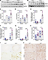 Myeloid FtH deficiency confers susceptibility to ferroptosis following inju