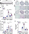 Excessive ferroptotic activity as the principal driver of kidney injury in